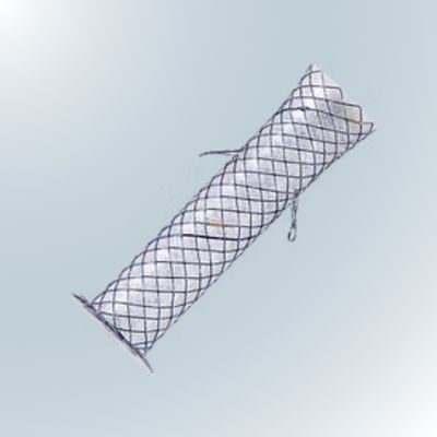 Fully Covered for Choledochal Duodenostomy